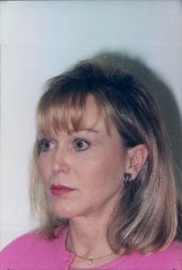 Female Facelift Patient 42 - After - 1 Thumbnail