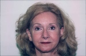 Female Facelift Patient 20 - After - 1 Thumbnail