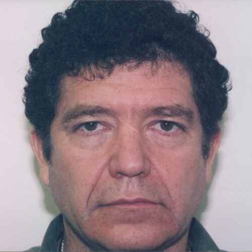 Male Facelift Patient 05 - Before - 1